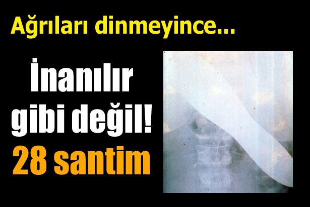 Karnında Mala Unutuldu