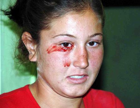 16 yasindaki cigdem kan agliyor 870257 - Medya Haber 16 yasindaki cigdem kan agliyor 870257