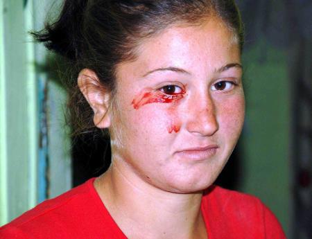 16 yasindaki cigdem kan agliyor 870259 - Medya Haber 16 yasindaki cigdem kan agliyor 870259