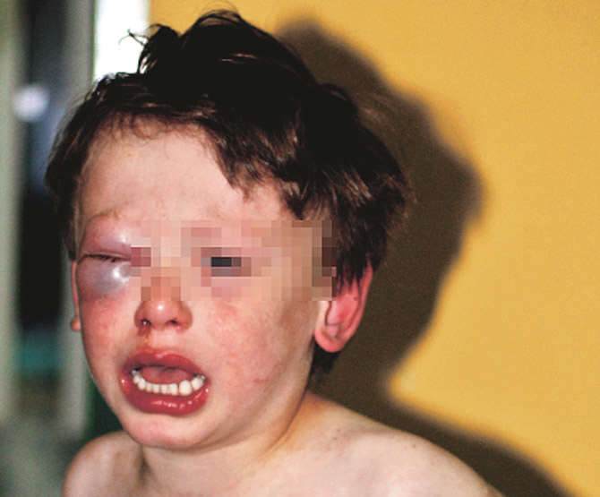 ÜVEY ANNE DEHŞETİ Yaşam Haberleri