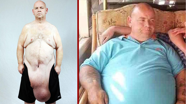 95-kilo-verince-bu-hale-geldi-3082552.Jpeg