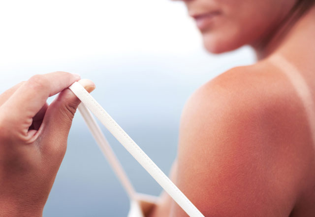 Güneşin cilde zararları çok büyük Sağlık Haberleri